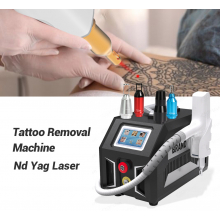 Q-switched Nd-YAG laser 2000 na odstránenie tetovania a omladenie
